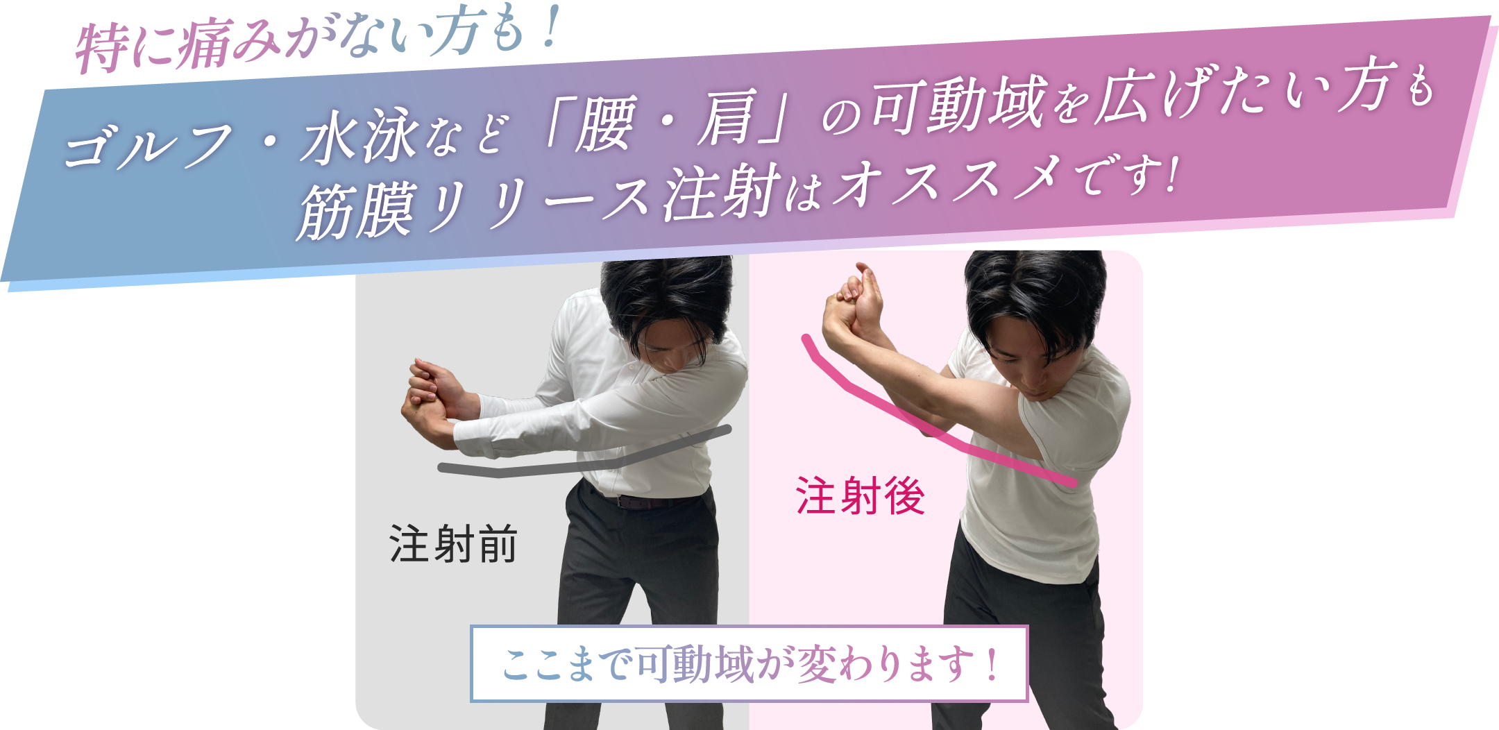 注射直後、見た目がこんなにも変わります！