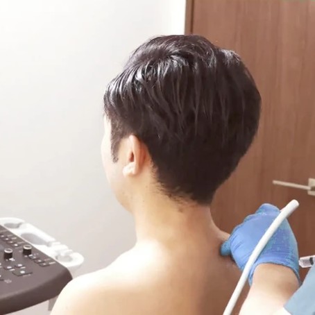 エコーを当てて男性の肩を確認している様子
