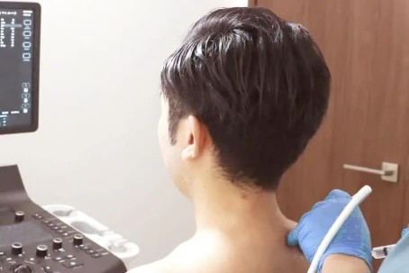 筋膜リリース注射