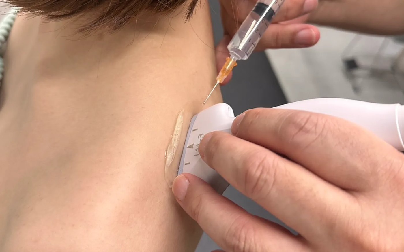 首に筋膜リリース注射を行っている様子