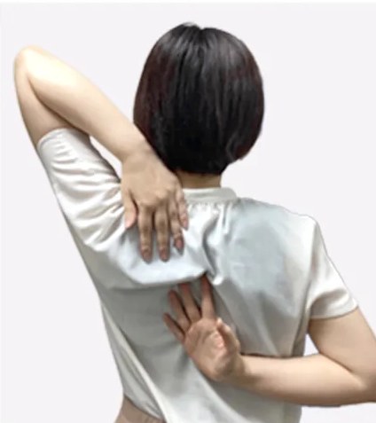 Case 01 施術前
